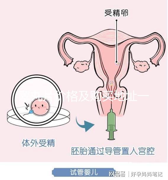 睪丸片價格及購買地址一覽 只需198元