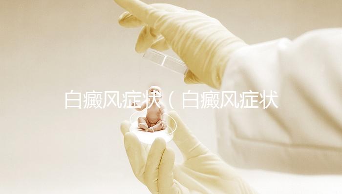 白癜風癥狀（白癜風癥狀圖片）
