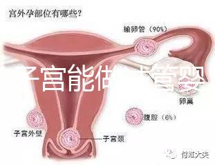 雙角子宮能做試管嬰兒嗎？可以，但這2大條件缺一不可
