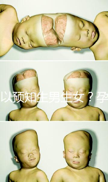 可以預知生男生女？孕婦夢見馬的胎夢解讀