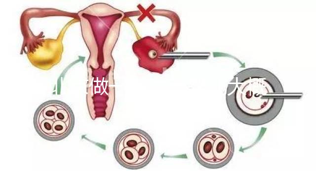 北京做一次試管嬰兒大概得多少錢？附試管醫院收費價目表!
