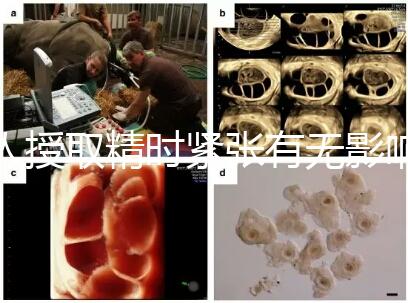 人授取精時(shí)緊張有無影響別還不造,注意事項(xiàng)不少不可不知