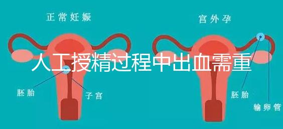 人工授精過程中出血需重視！這3種情況會影響成功率