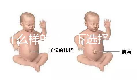 什么樣的情況下選擇做試管嬰兒?