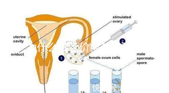 為什么試管價格差異那么大？做試管到底要花多少錢？