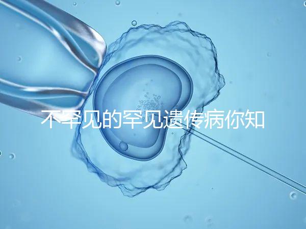 不罕見的罕見遺傳病你知道嗎?帶你認(rèn)識(shí)下特納綜合癥