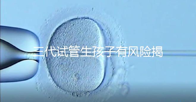 三代試管生孩子有風險揭秘嗎？嬰兒會有問題嗎？