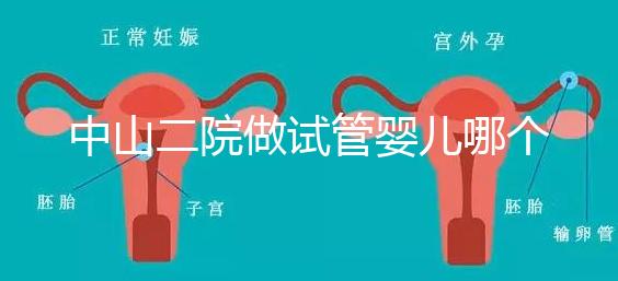 中山二院做試管嬰兒哪個醫(yī)生好？附醫(yī)院試管成功率