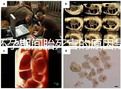 懷孕期間胎死宮的原因是什么？