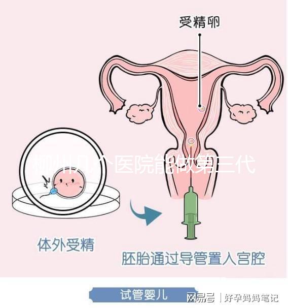 柳州幾個(gè)醫(yī)院能做第三代試管嬰兒？詳細(xì)的費(fèi)用成功率都在這