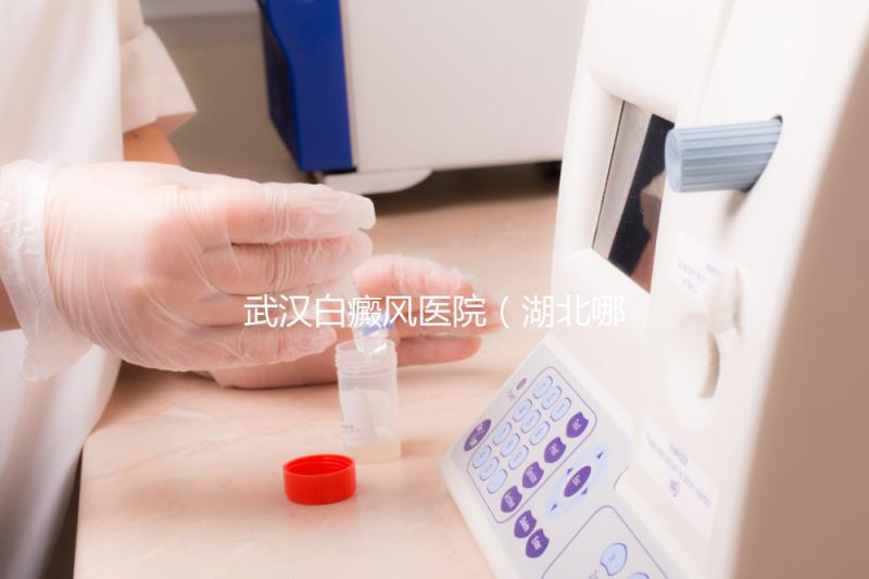 武漢白癜風醫(yī)院（湖北哪家醫(yī)院白癜風最好）