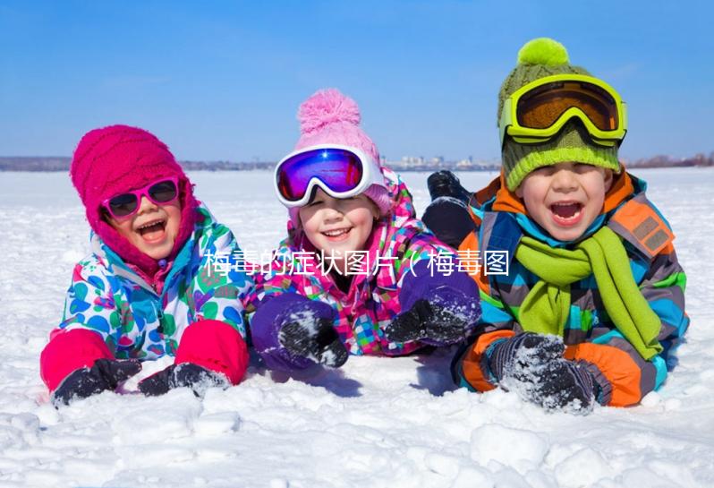 梅毒的癥狀圖片(梅毒圖片男性癥狀圖片)