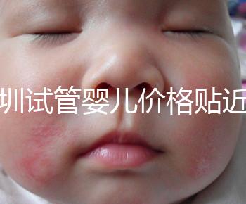 深圳試管嬰兒價格貼近百姓！三代試管只需8