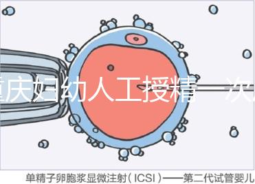 重慶婦幼人工授精一次成功率揭秘，移植費用貴有原因