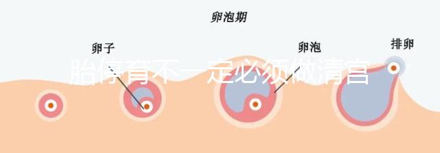胎停育不一定必須做清宮！不滿足這3種情況,無需要刮宮
