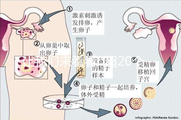 讓我們來(lái)看看b超20個(gè)卵子取10個(gè)是不正常的我們?cè)撛趺崔k？