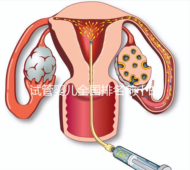 試管嬰兒全國(guó)排名前十的醫(yī)院:2024年最新試管嬰兒全國(guó)排名前十的醫(yī)院新鮮出爐