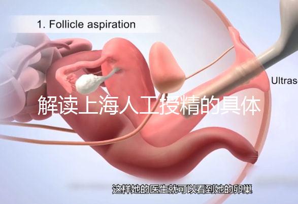 解讀上海人工授精的具體過程,會不會痛看醫生怎么說?