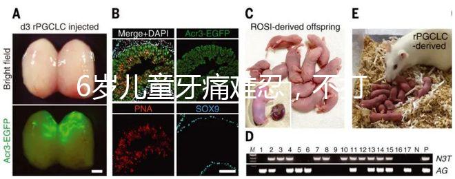 6歲兒童牙痛難忍，不打針吃藥5個(gè)小妙招快速止疼