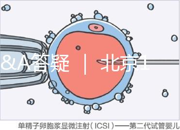 Q&A答疑 | 北京16項(xiàng)輔助生殖技術(shù)進(jìn)醫(yī)保,試管可以報(bào)銷嗎?